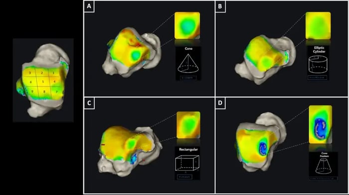 Imaging pre-operatorio.