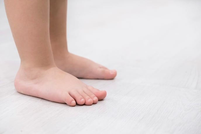 ginnastica correttiva piede piatto bambino