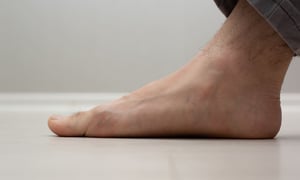 piede piatto esercizi