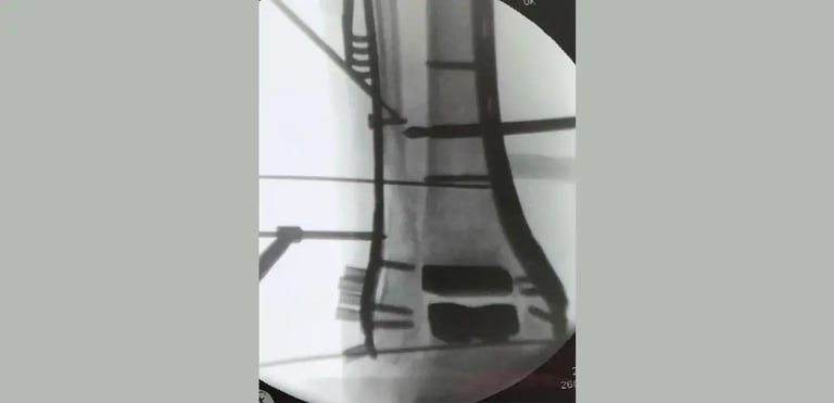 post-operazione-min