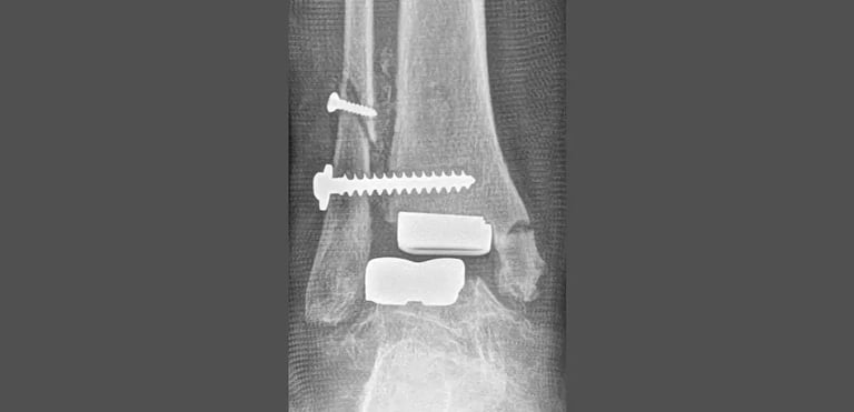 pre-operazione-min