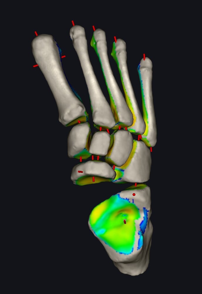 radiografia sotto carico