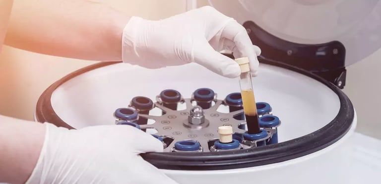 centrifuga-per-plasma-o-prp-min