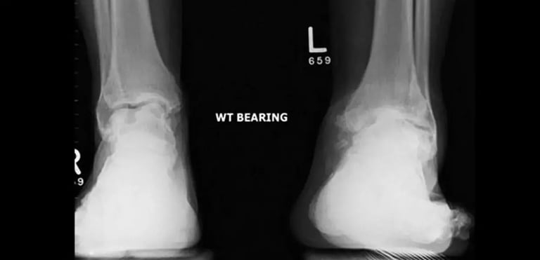 imaging-bearing