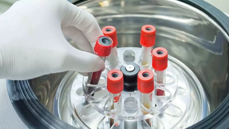centrifuga-per-sangue-desktop-min.jpg