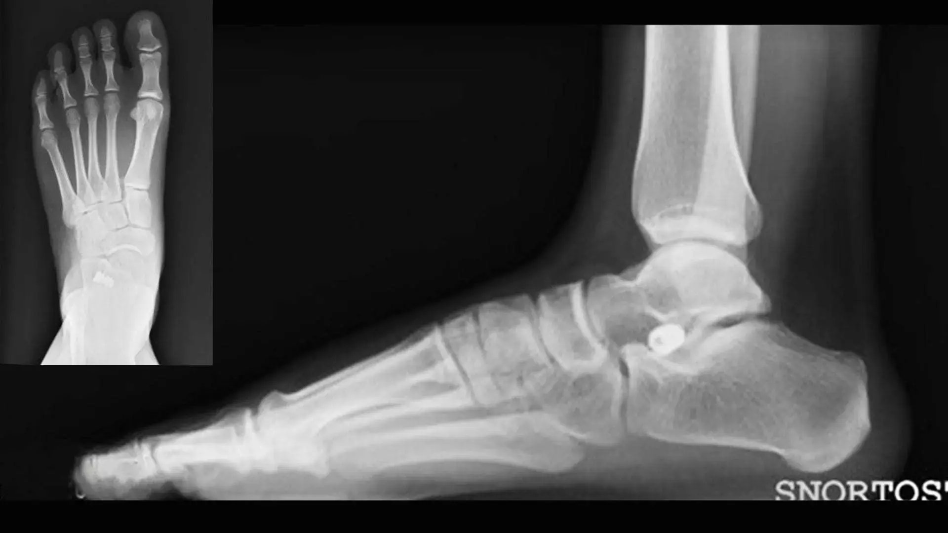 Radiogradia Endortesi
