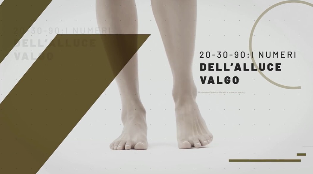 Thumbnail video i numeri dellalluce valgo.