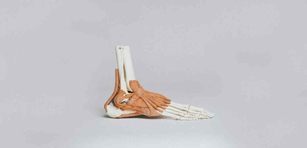diagnosi dell'alluce valgo