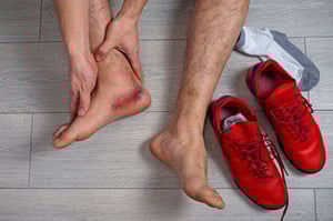 distorsione di caviglia