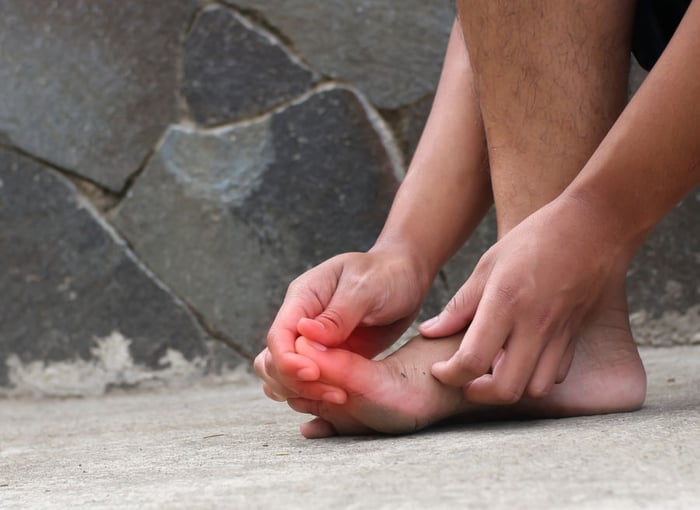 Foto di un uomo con una neuropatia alle dita dei piedi.