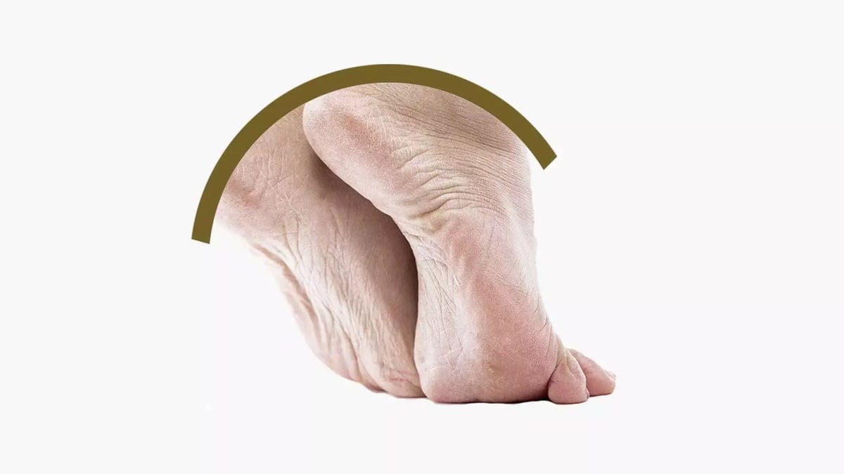 patologia-piede-cavo-desktop-min.jpg