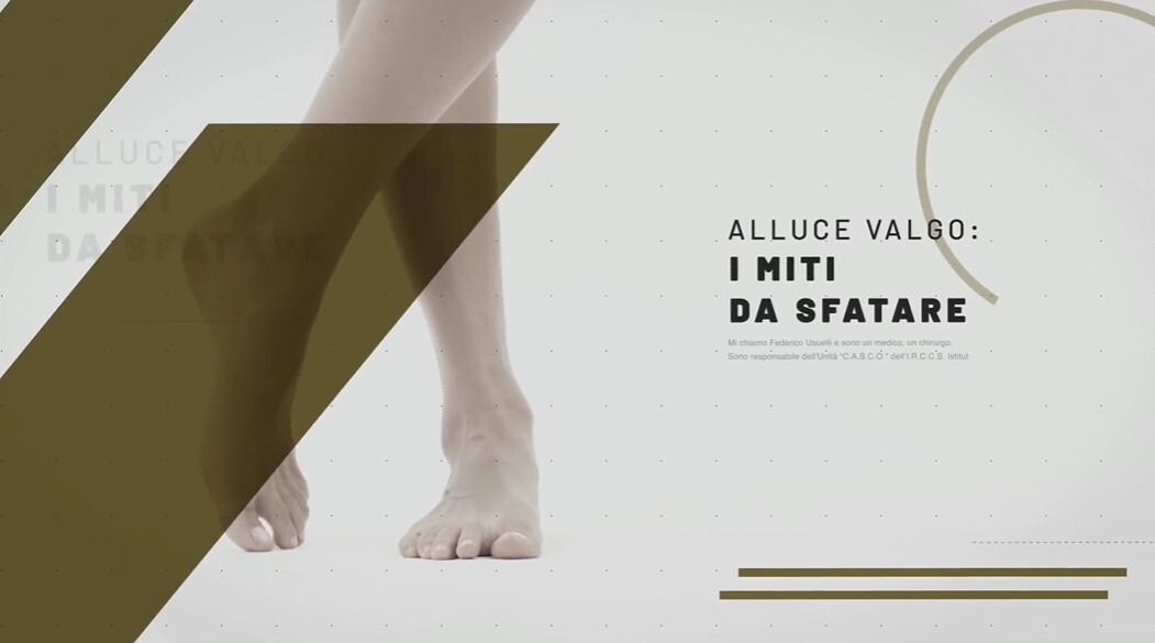 Thumbnail del video sui miti relativi all'alluce valgo.