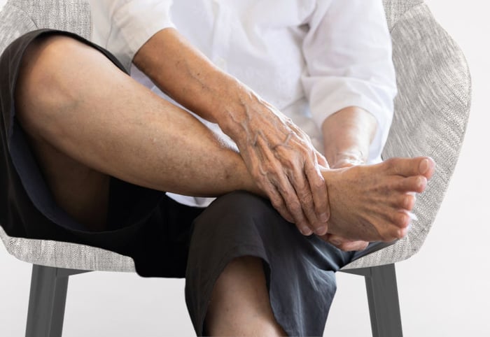 Un uomo si massaggia la caviglia a causa del bruciore tipico della sindrome del tunnel tarsale.