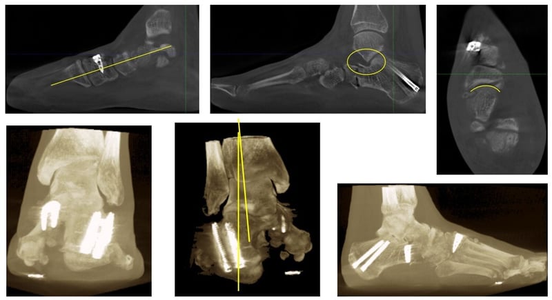 tac in carico post intervento