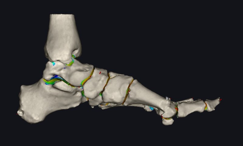 tac-in-carico-pre-post-op-osteotomia