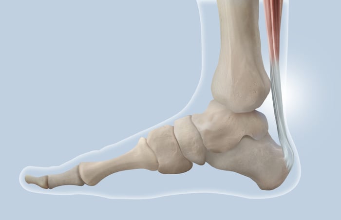 Illustrazione che mostra la struttura anatomica del tendine d'Achille.