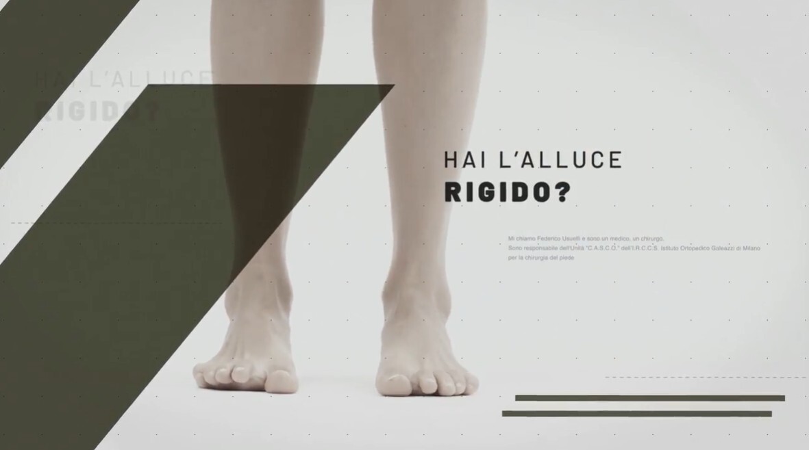 thumbnail del video sull'alluce rigido
