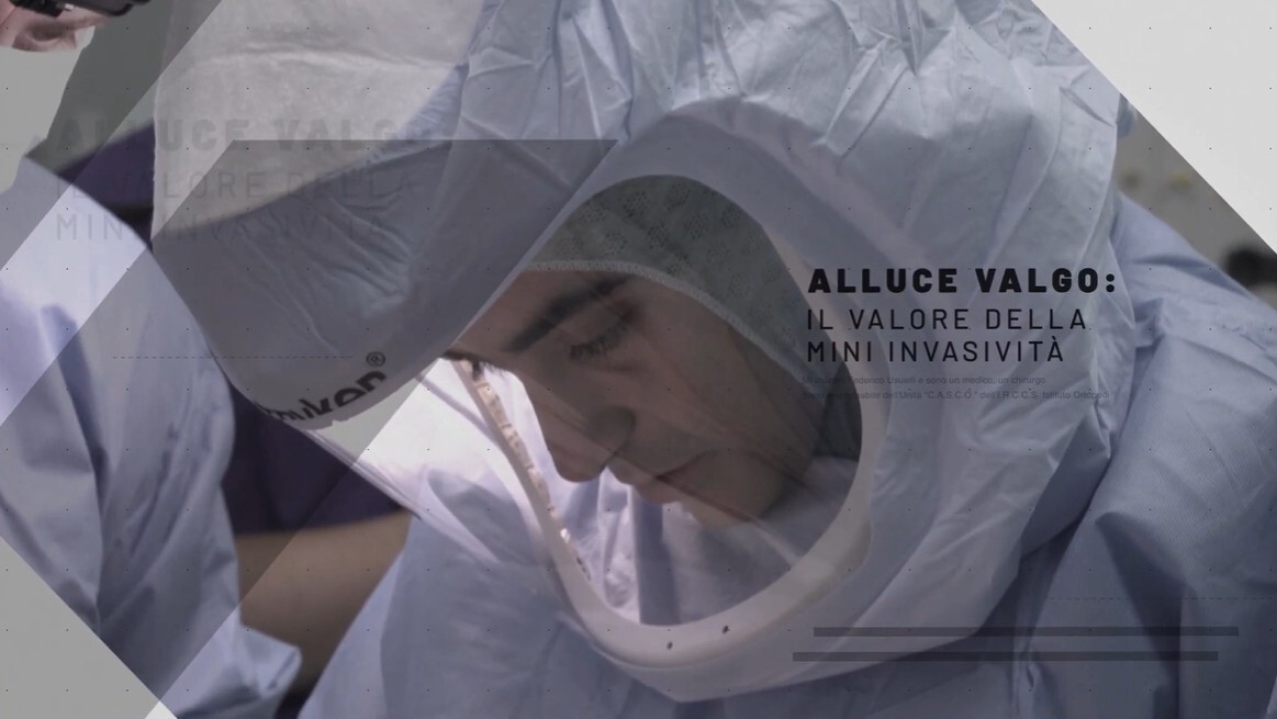 Thumbnail video sull'intervento mini-invasivo per la correzione dell'alluce valgo.