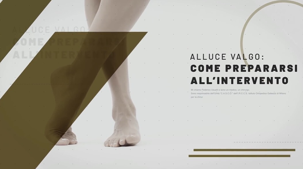 Thumbnail del video sulla preparazione all'intervento per alluce valgo.