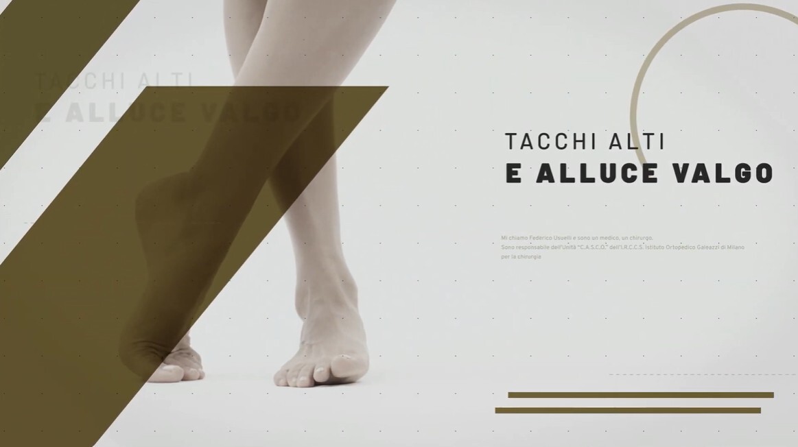Thumbnail del video sulla mancanza di legami fra l'uso dei tacchi alti e l'insorgenza dell'alluce valgo.
